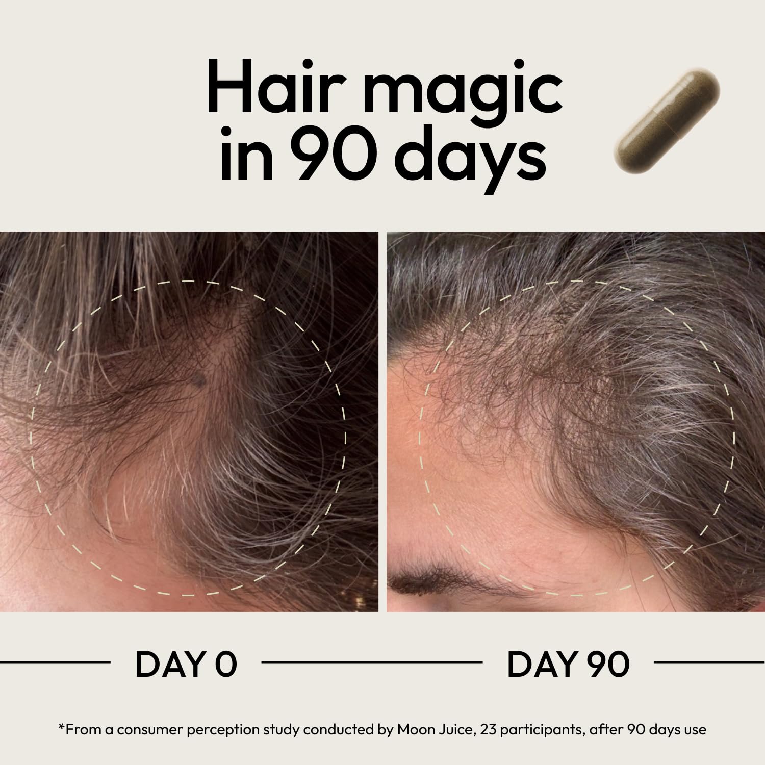 Hair Growth Vitamins Biotin Saw Palmetto 120 Capsules