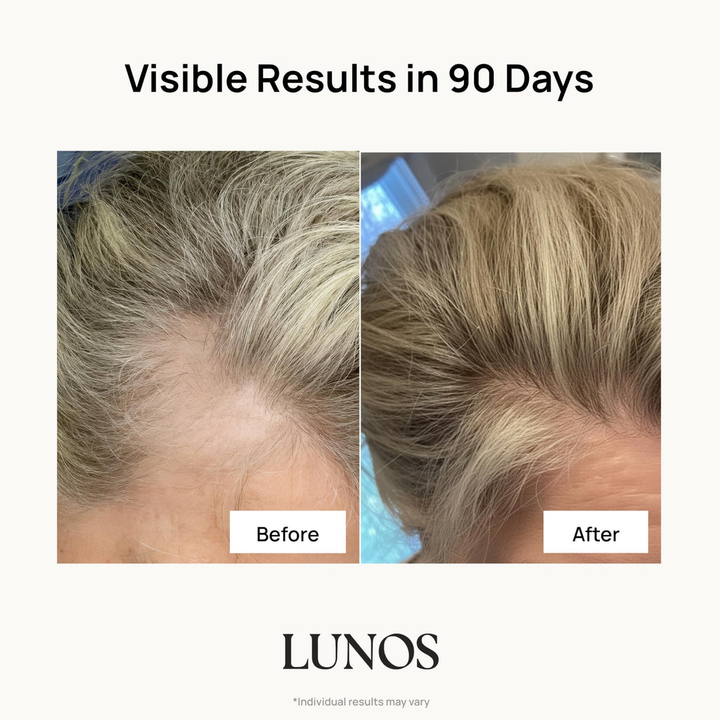 Hair Growth Vitamins Biotin Collagen Saw Palmetto