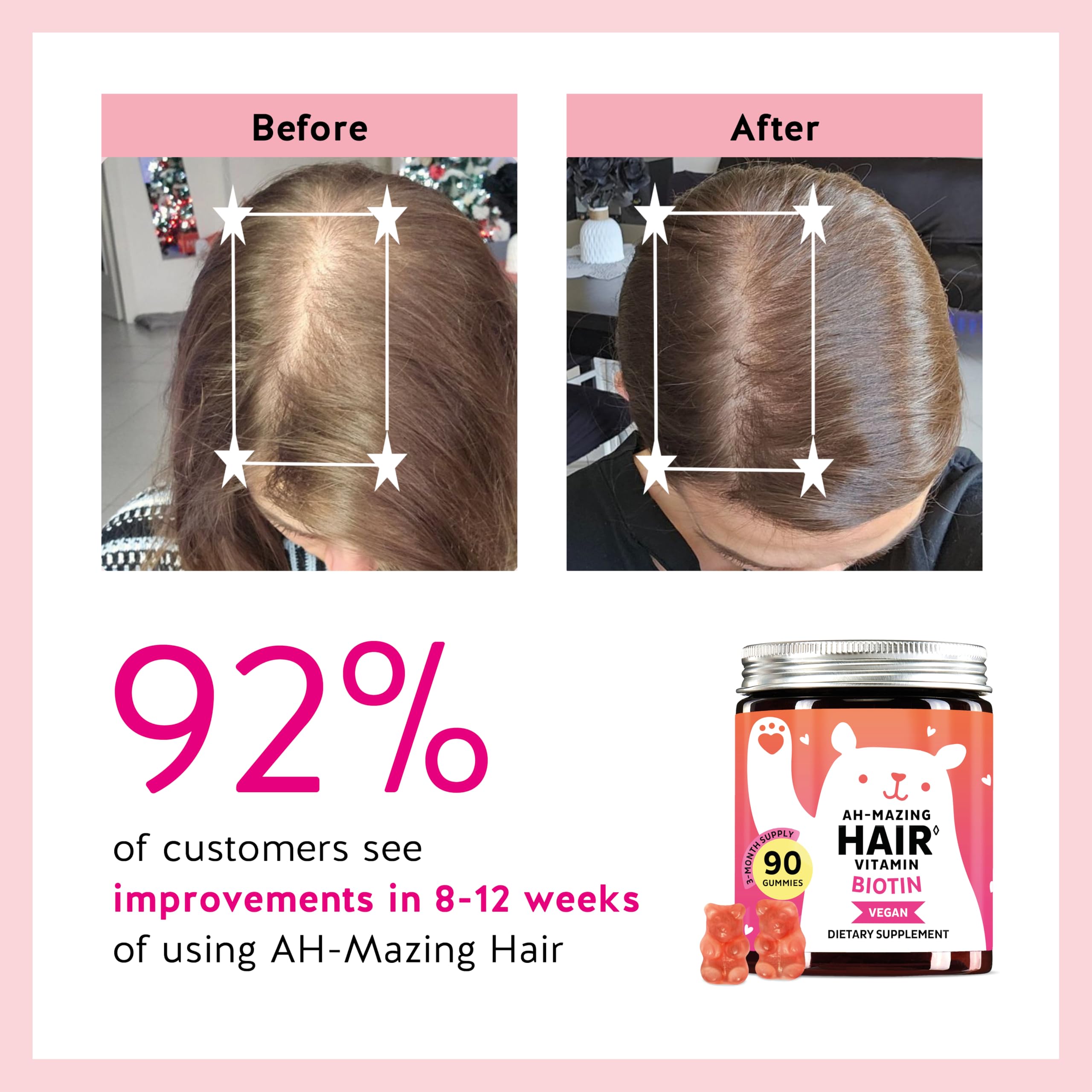 Biotin Gummies 5000mcg Hair Skin Nails Vitamin C E 90 Count
