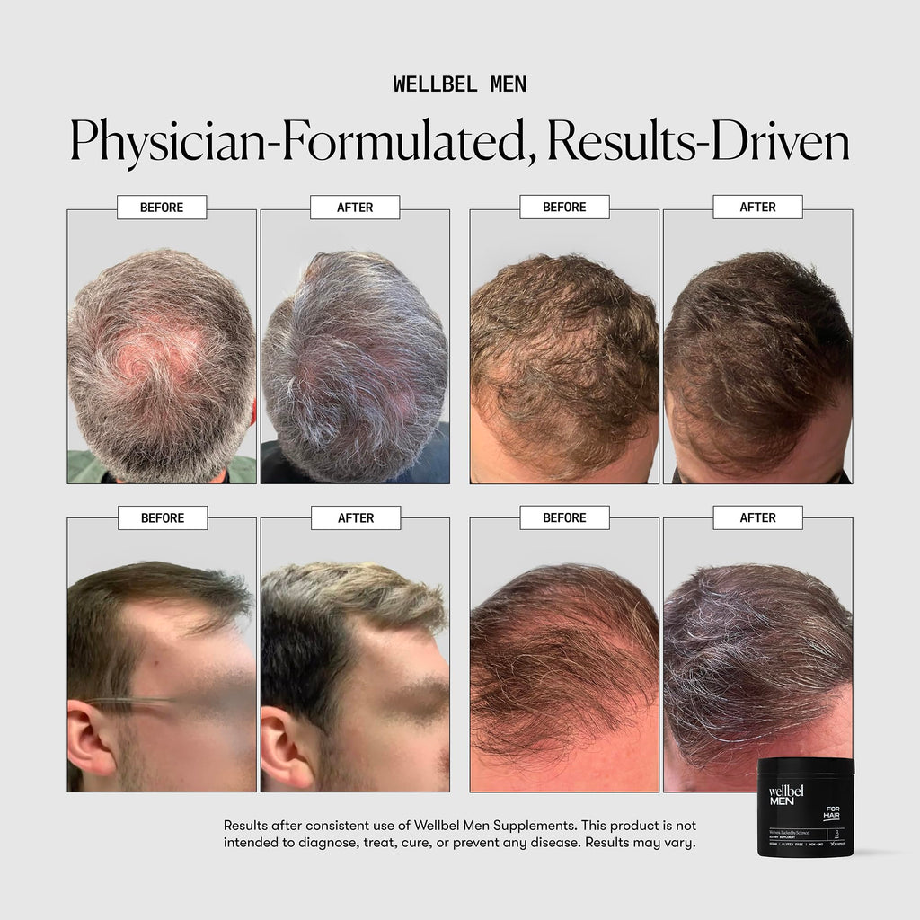 Men’s Hair Skin Nails Vitamins Vegan 90 Count
